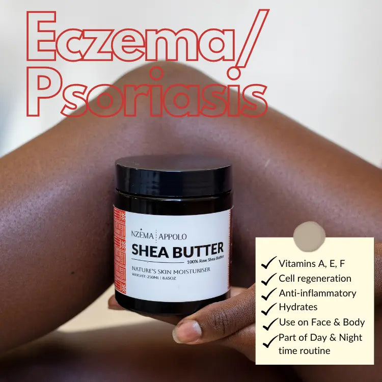 Shea Butter Eczema & Psoriasis skin benefits