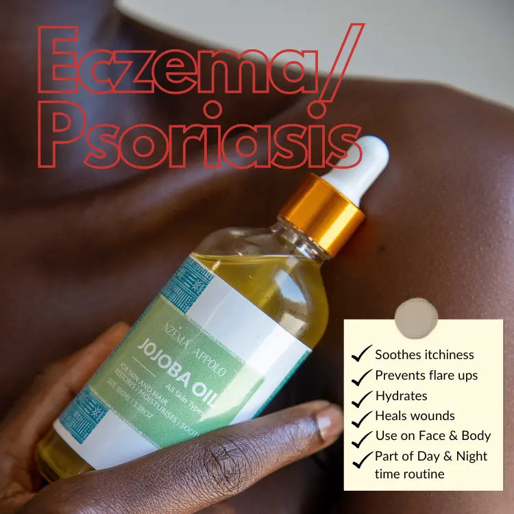 Nzema Appolo Cold-Pressed Hydrating Jojoba Oil 100ml - Super Oil, Eczema, Psoriasis, Premature Ageing Nzema Appolo