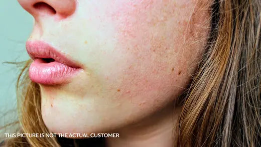 Nzema Appolo Skincare Heroes: Real Customer Story Transformation of Dry Skin Nzema Appolo